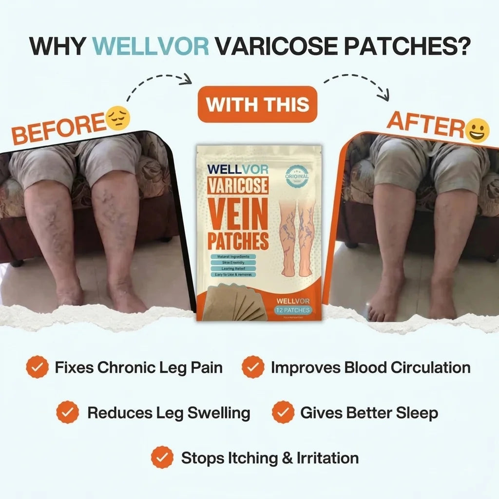 The Original Varicose Vein Relief Patches by Wellvor